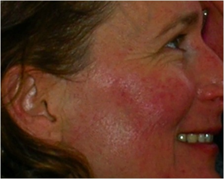 My Red Face